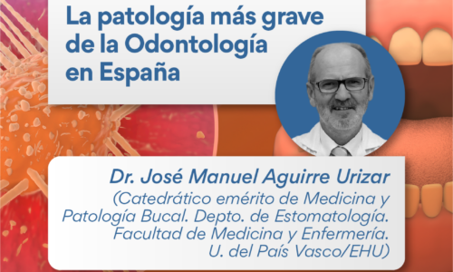 Webinar en directo “El cáncer oral” – 29 de septiembre